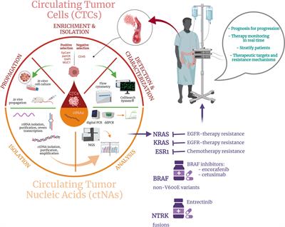 Liquid Biopsy and Artificial Intelligence as Tools to Detect Signatures of Colorectal Malignancies: A Modern Approach in Patient’s Stratification